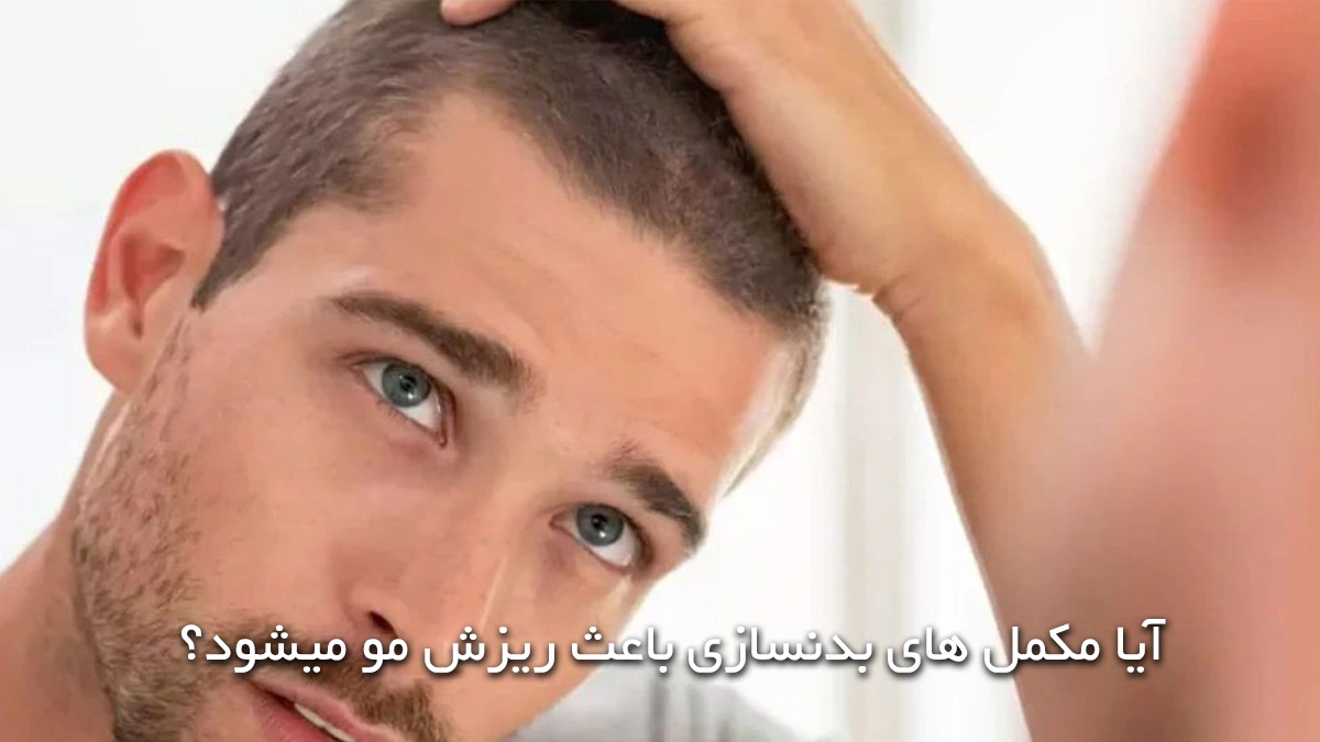 مرد جوانی که در آینه خط رویش موهای خود را می بیند