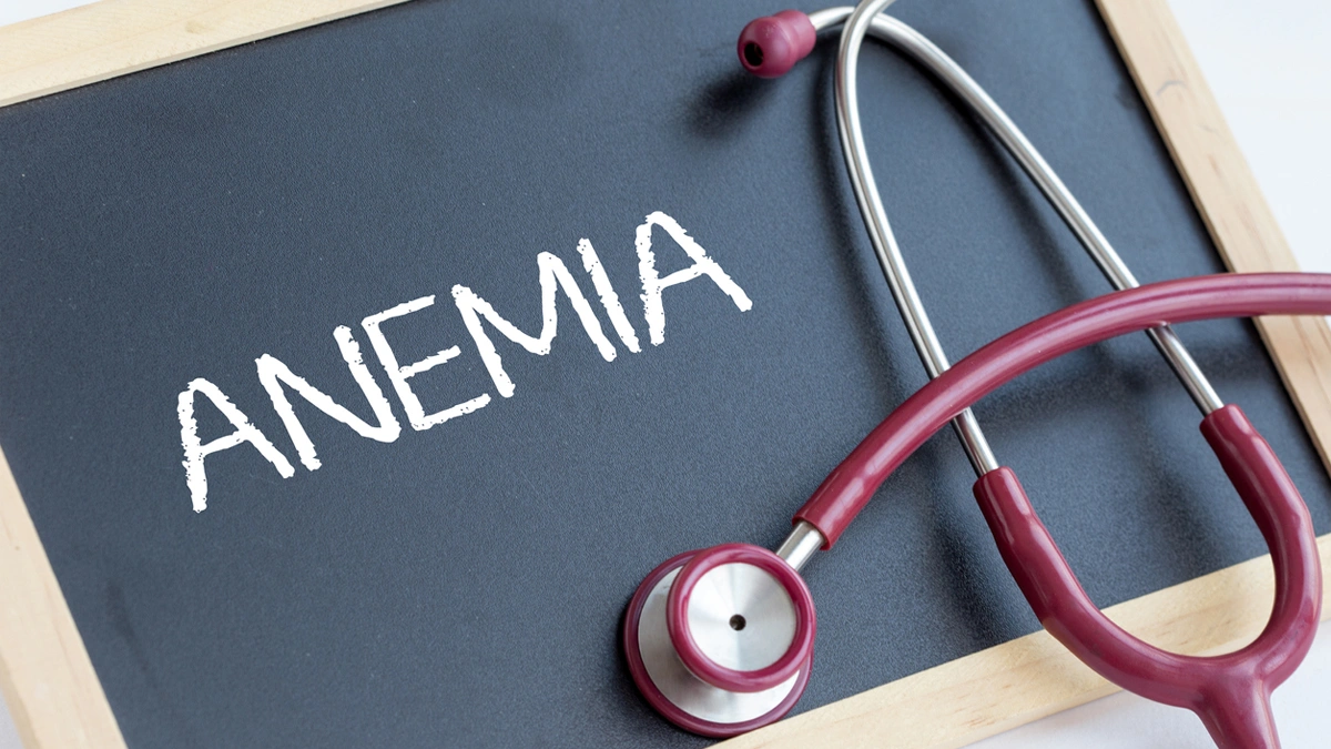 عکس گوشی پزشکی روی یک تخته که روی آن کلمه آنمی نوشته شده است